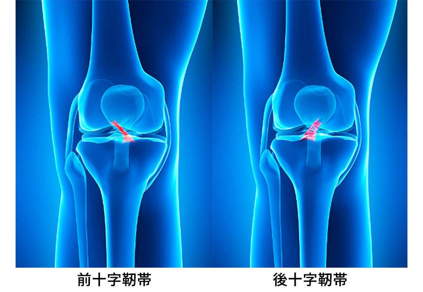 靭帯損傷