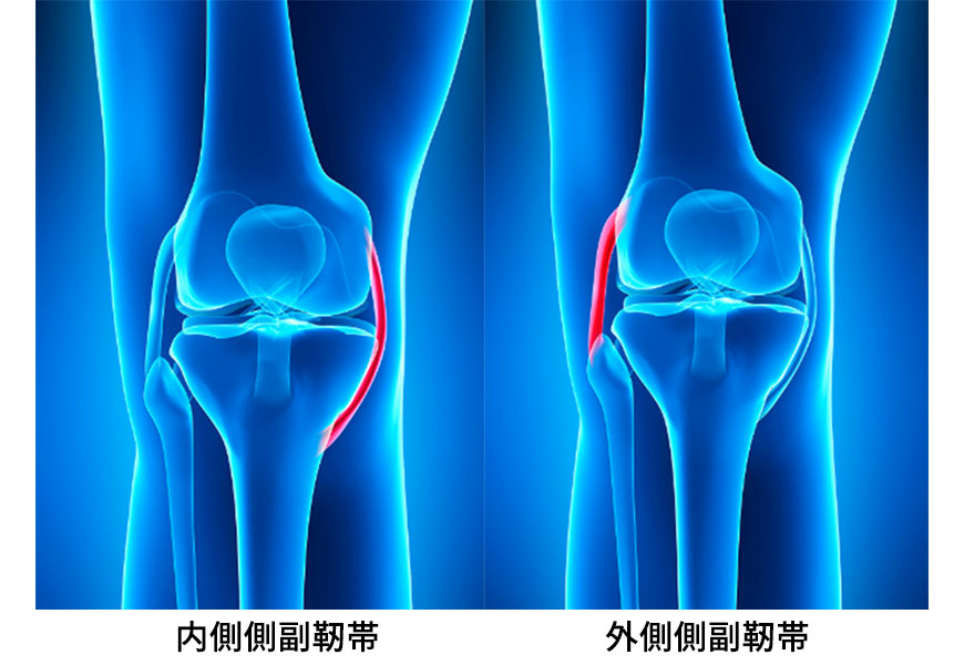 靭帯損傷