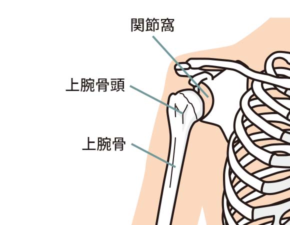 肩が脱臼する原因・症状