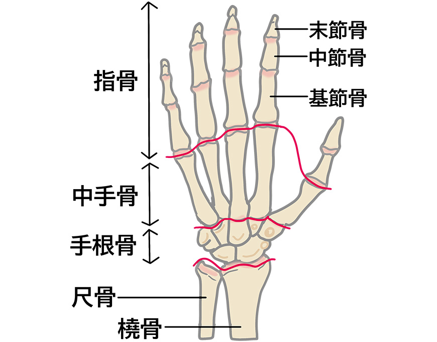骨折・突き指