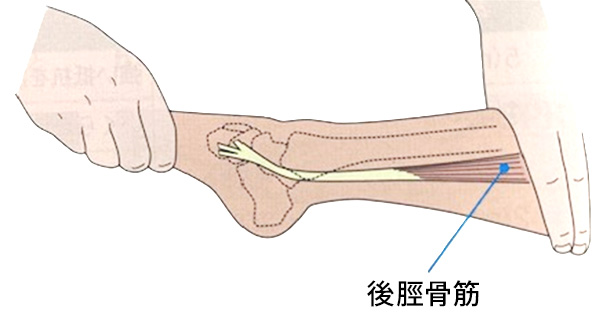 後脛骨筋機能不全とは