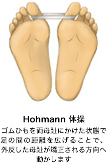 Hohmann運動、足趾を開く運動