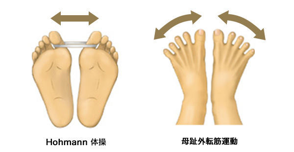 外反母趾_運動療法