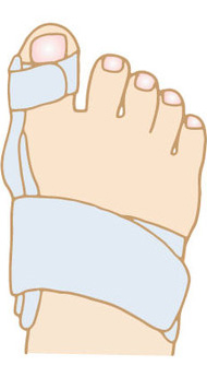 外反母趾_装具療法