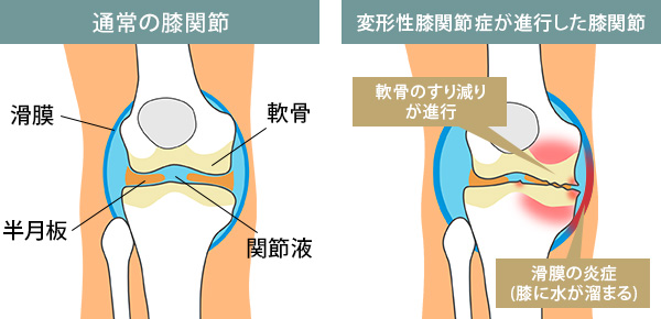 具体的な症状
