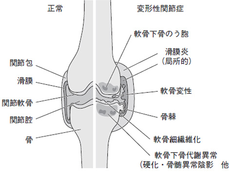 原因