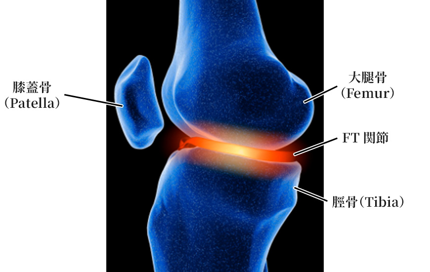 関節軟骨障害の痛み