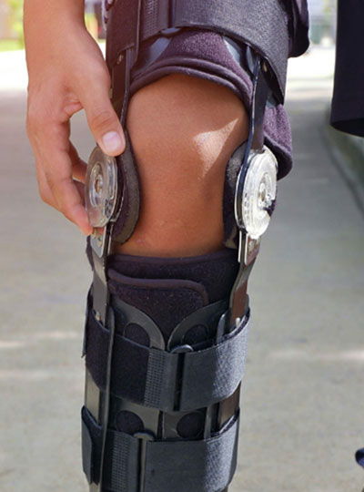 膝の機能障害を補う装具治療
