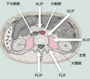腰椎の高さでの腹部臓器をふくめた解剖の図