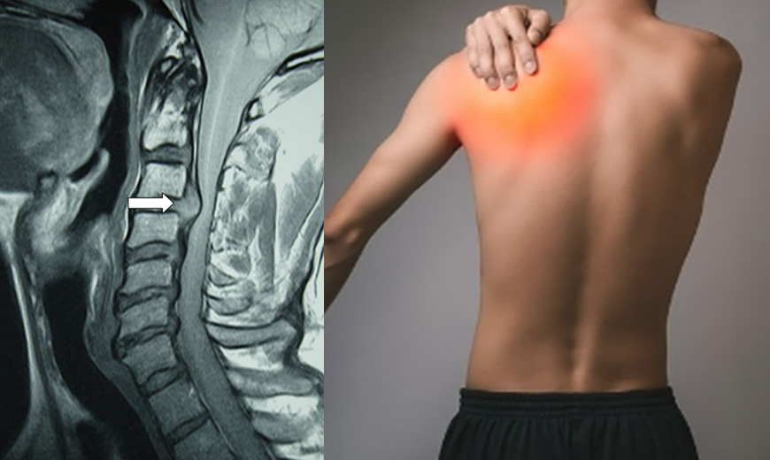 神経が原因のケース