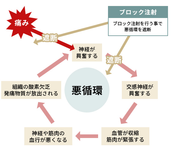 神経ブロックの仕組み