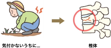 背中や腰が痛む（圧迫骨折）