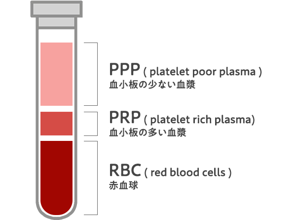 PRP療法とは