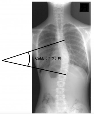 どうやって診断するか