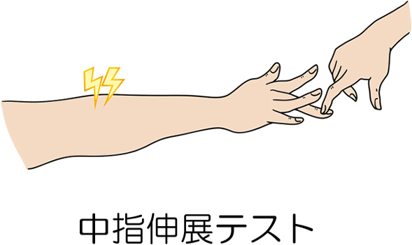中指伸展テスト